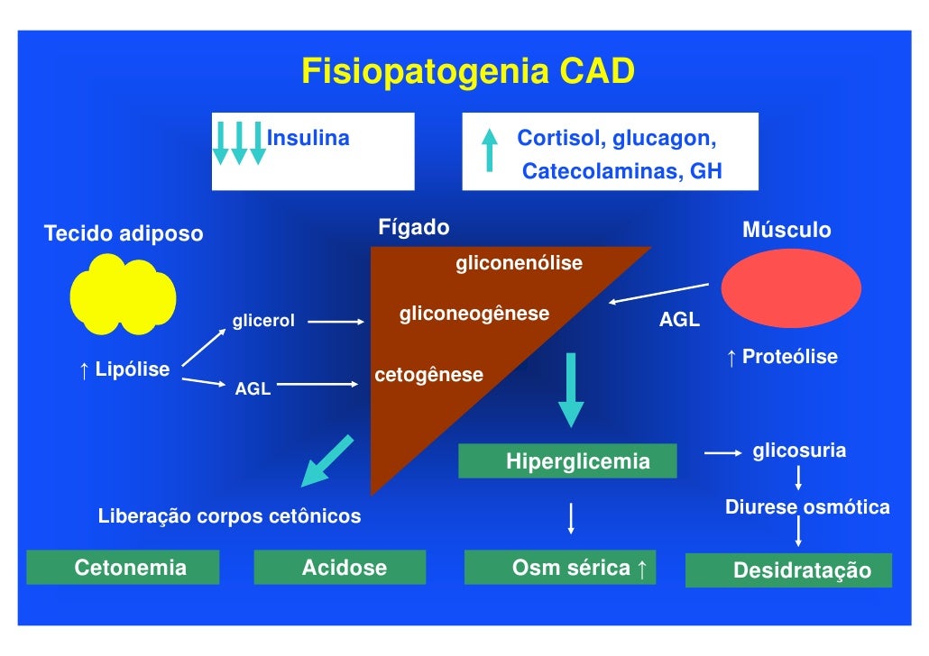 ketoacidose ketoacidose